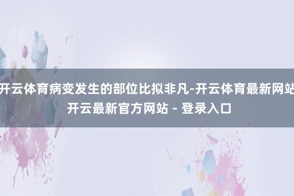 开云体育病变发生的部位比拟非凡-开云体育最新网站 开云最新官方网站 - 登录入口